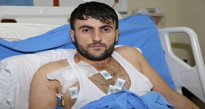Yangını söndürmek isterken bacaklarından oluyordu