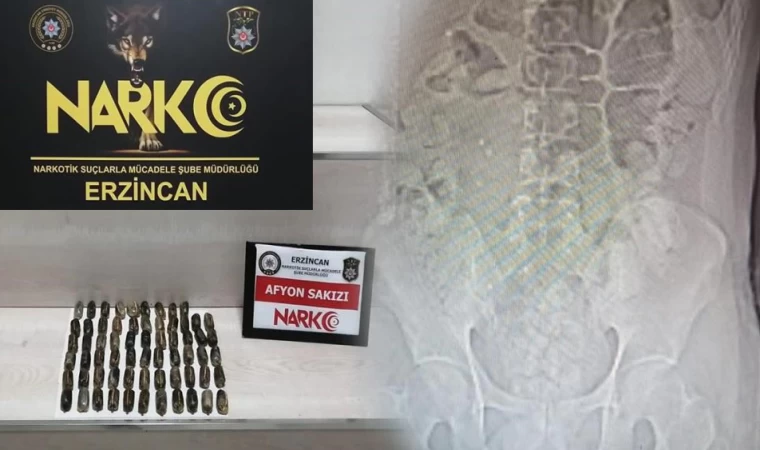 İranlı kuryenin midesinden 711 gram uyuşturucu çıktı
