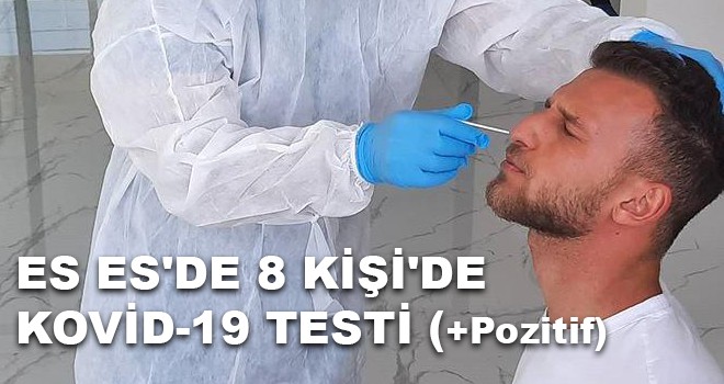 ES ES'DE 8 KİŞİ'DE KOVİD-19 TESTİ (+Pozitif)