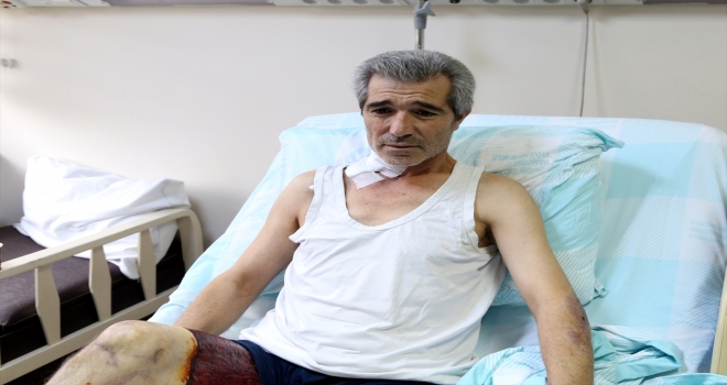 Doku nakli ile bacağı kesilmekten kurtuldu