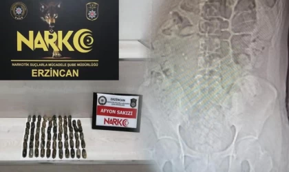 İranlı kuryenin midesinden 711 gram uyuşturucu çıktı