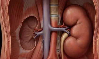 Bir Böbrek Alındığında diğer böbrek Dönüşür