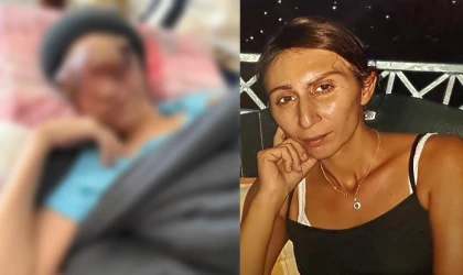 Gonca, Tedavi Umuduyla Verdiği Mücadeleyi Kaybetti